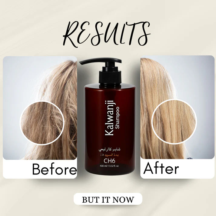 Organic Kalwanji Black Seed Shampoo 250ml – BUY 1 GET 1 FREE - MIP